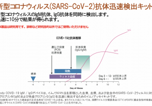 <h1>新型コロナウイルス抗体検査受付開始</h1>